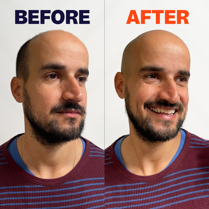 FlexSeries® Pro Shaving Kit